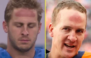 Jared Goff 'channels inner Peyton Manning' with huge red forehead mark